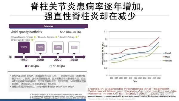 强直性脊柱炎最新治疗策略揭秘